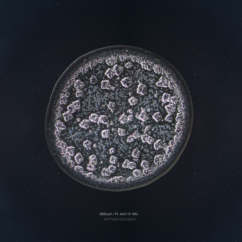 Illustration for article titled The Beautiful Secrets of Tears, Revealed By a Microscope